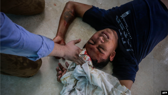 Joven herido durante manifestación por libertad de los detenidos en Nicaragua
