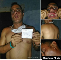 Golpiza y multa al opositor Zaqueo Báez publicado en su página de Facebook