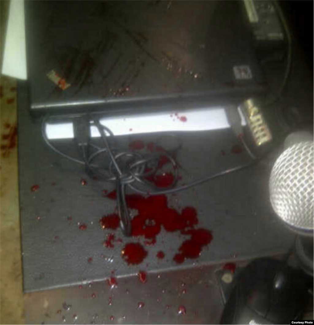 Fotografía cedida por el equipo de prensa del partido político venezolano "Primero Justicia" donde se observa al diputado opositor Julio Borges, ensangrentado, golpeado en un ojo y con el pómulo izquierdo visiblemente hinchado hoy, martes 30 de abril del 2013