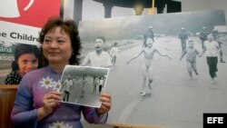 Kim Phuc muestra la famosa fotografía de la guerra de Vietnam que ella protagonizó.